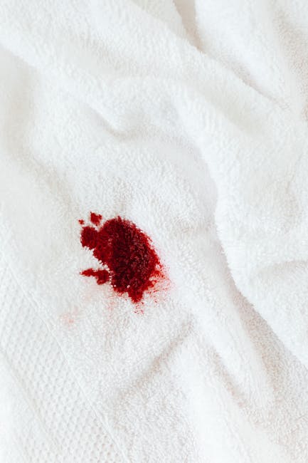 Close-up image of a white fabric or towel with a vivid red stain, possibly from a drink spill or food. The surface appears soft and textured, indicating a cloth material. The stain is concentrated in the center with some smaller surrounding spots, and the fabric shows slight wrinkles around the area. The image is well-lit, highlighting the contrast between the clean white background and the bright red stain. This scene exemplifies the importance of surface cleaning and stain removal in domestic or commercial settings. For effective stain treatment and deep cleaning, Carpet Cleaners Kentish Town offers professional solutions to restore hygiene and appearance to fabric surfaces, especially in settings like the Kentish Town Forum or other communal spaces. Proper sanitisation ensures a hygienic environment, and timely stain removal prevents permanent damage to fabrics and carpets. The image underscores the need for specialised stain removal techniques as part of regular maintenance and surface cleaning routines.
